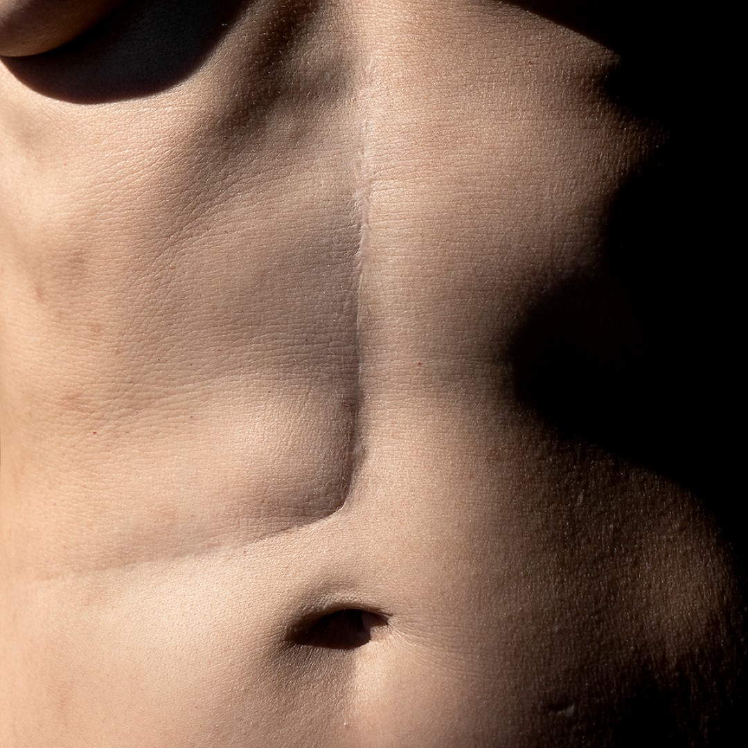 Pilar_Piedra_La cicatriz del guerrero_2